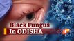 Black Fungus Found In #COVID19 Survivors In Odisha, Doctor Explains Ways To Prevent | OTV News