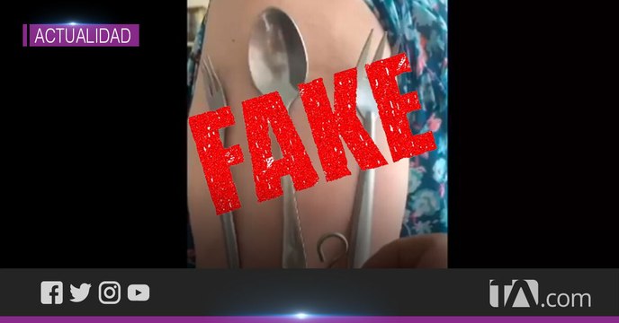 Por tu salud: Expertos desmienten el supuesto efecto magnético que causan las vacunas