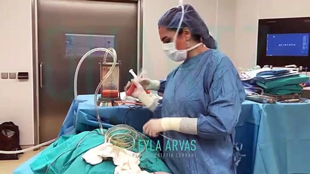 POPO ESTETİĞİ (Brazilian Butt Lift) KALICI MI_! |  Op. Dr. Leyla Arvas