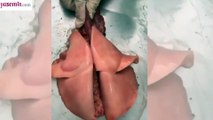 Kedi akciğeri görenleri şaşırttı!