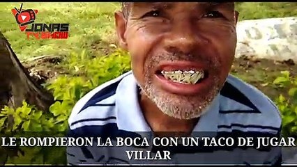 LE DESARMARON LA BOCA A ESTE HOMBRE POR UNA DISCUSION