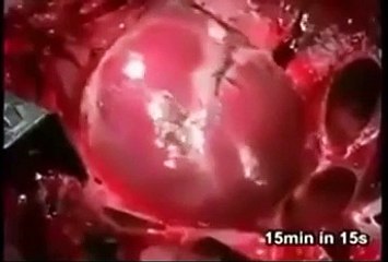 Ruh bedenden çıkarken insanın kalbinin durduğu an!