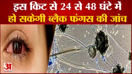 Black Fungus की पहचान करना आसान,Scientists की Dutch Kit से 24-48 घंटे में चल जाएगा संक्रमण का पता