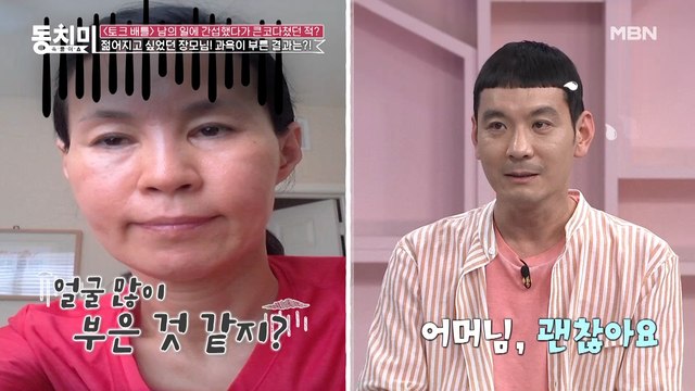 개그맨 정성호, 장모님 미용 시술에 참견했다가 큰일 날 뻔했다?! (feat. 빛나는 콧대)