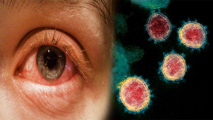 Corona से ठीक होने के बाद जा सकती है आंखों की रोशनी? जानिए क्या कहते है Experts । Boldsky