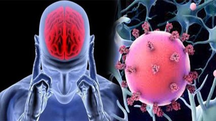 Corona Patient में  देखी जा रही है ये गंभीर दिमागी बीमारी, पहचाने इसके Symptoms । Boldsky