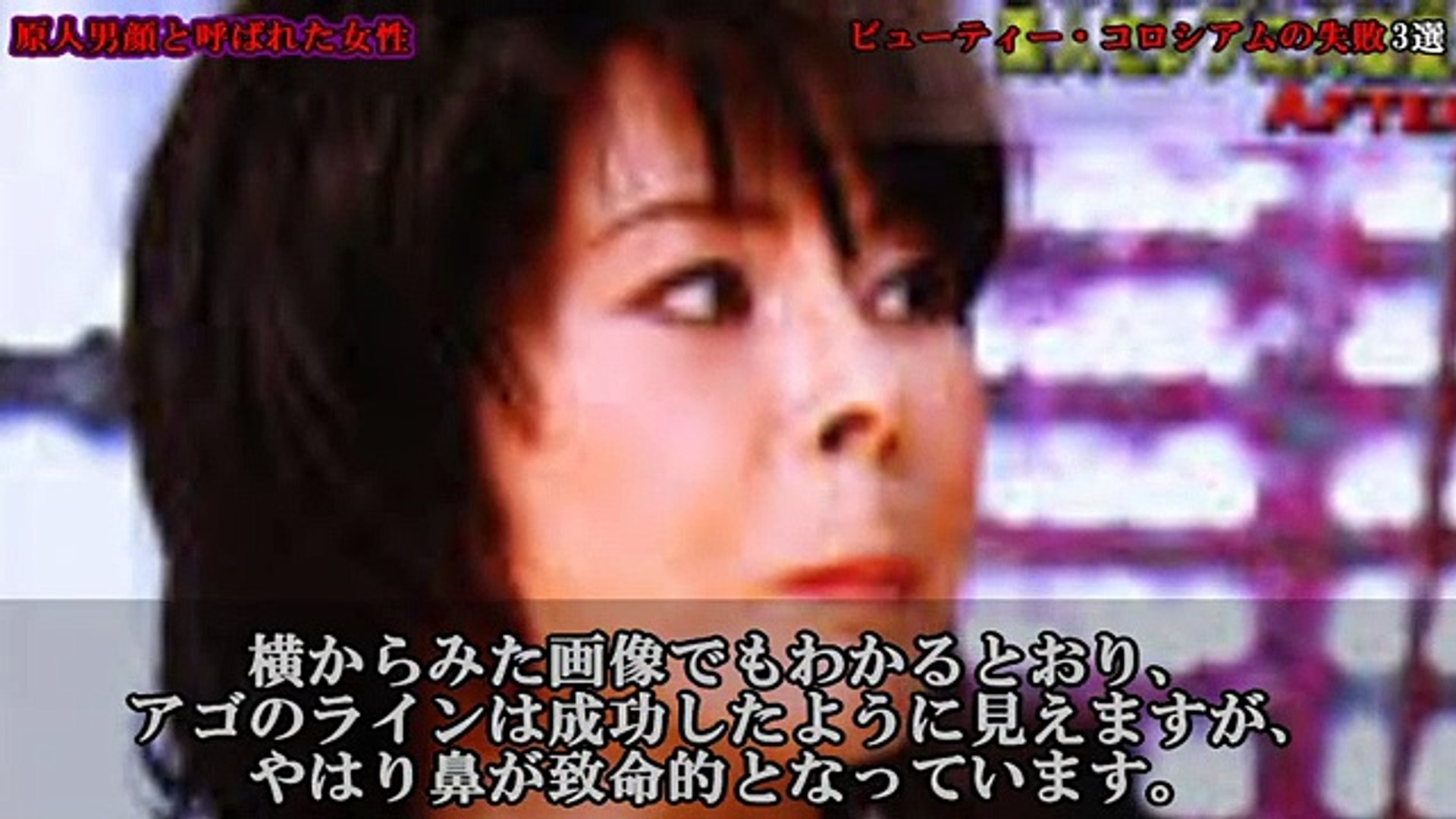 放送事故 ビューティー コロシアムの失敗 3選 動画 Dailymotion