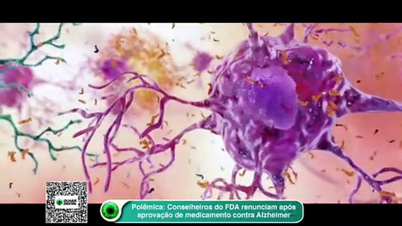 Polêmica- Conselheiros do FDA renunciam após aprovação de medicamento contra Alzheimer