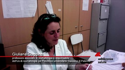 Spondilite anchilosante, Guggino (UniPa): "Upadacitinib importante scoperta per riduzione dolore"