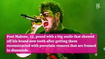 Post Malone Spends $1.6 Million On New Smile With Diamond Vampire Fangs