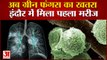 अब Green Fungus का आतंक, इंदौर में मिला पहला मामला | 'Green Fungus' Case Reported In Indore