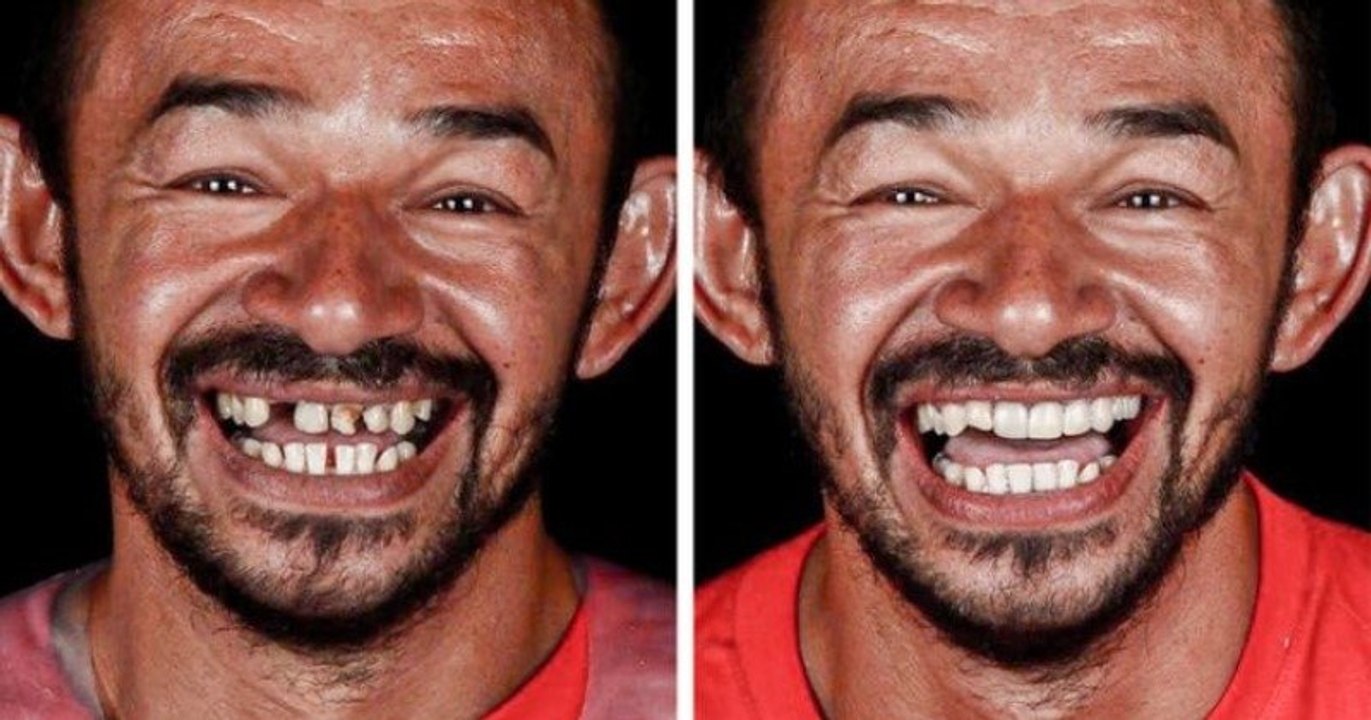 Ce dentiste brésilien voyage à travers le monde pour offrir des soins dentaires aux plus démunis