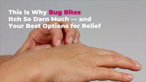 This Is Why Bug Bites Itch So Darn Much-and Your 8 Best Options for Relief