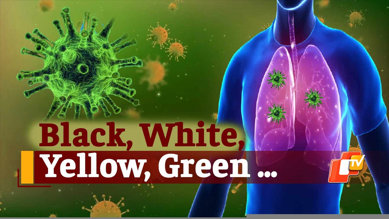 After Black, White and Yellow, Green Fungus Case Reported In Madhya Pradesh