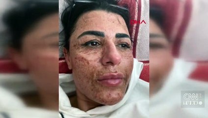 Güzellik salonu mağduru kadın sağlığına kavuştu