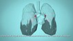 Respira la Vida - Cómo la contaminación del aire afecta a tu cuerpo - OMS