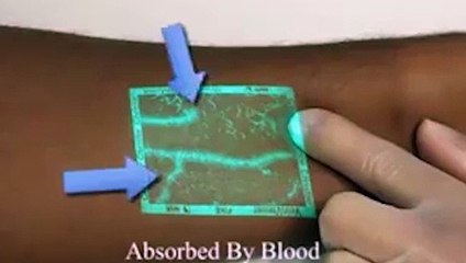 Damar görüntüleme cihazı denenmeye başlandı