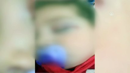 KAYSERİ - 3 yaşındaki oğluna sigara ve hap içirdiği iddia edilen kadın gözaltına alındı