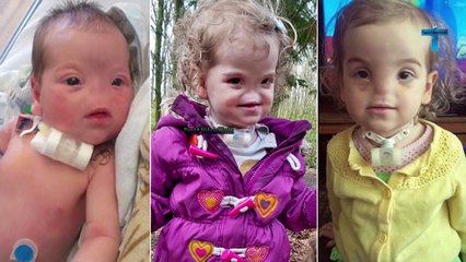 Everyone LAUGH AT HER FACE And Today She Is LIKE THIS! Top 10 Truly Unusual People