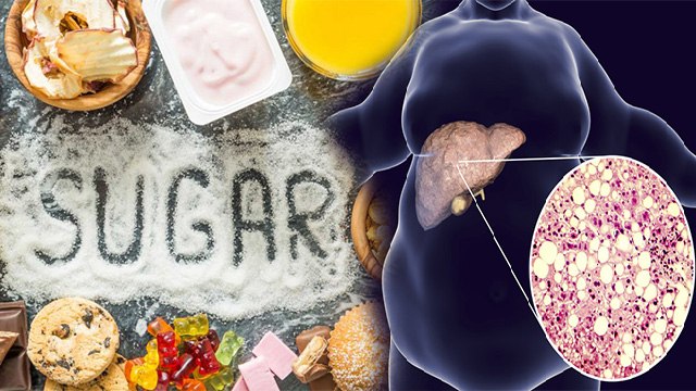 ज्यादा Sugar खाने से हो सकती है ये खतरनाक बीमारी | Excess Sugar can Damage your Liver | Boldsky