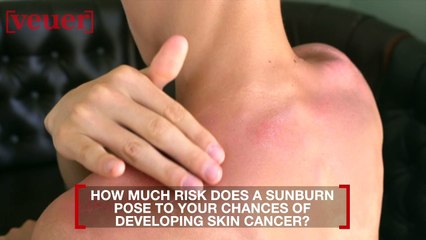 How Much Does One Sunburn Up Your Risk of Skin Cancer?