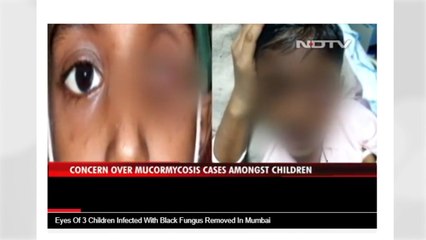 '검은 곰팡이증' 감염 인도 어린이 3명, 안구 제거 비극 / YTN