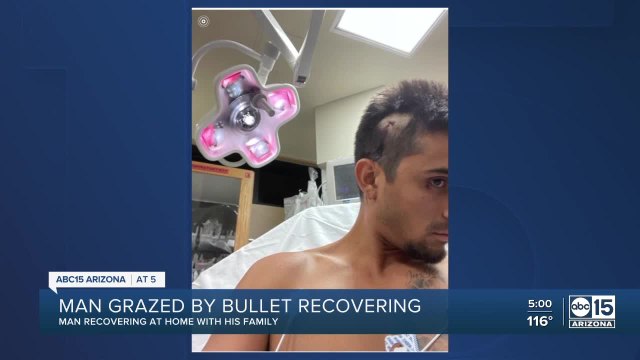 Man recovering after being grazed by bullet during West Vally shooting rampage