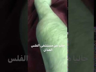 الفنان الكويتي عبدالله بهمن يكشف تعرضه لحالة مرضية غريبة