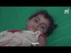 تحذير من عودة انتشار وباء الكوليرا في اليمن