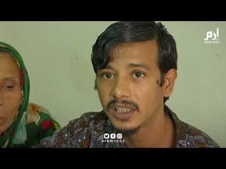 "الرجل الشجرة" يطلب بتر يديه بعد فشل عدة عمليات جراحية في علاجه