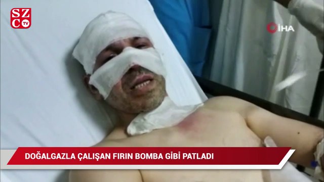 Doğal gazla çalışan fırın bomba gibi patladı: 1 yaralı