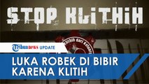 Remaja di Yogyakarta Jadi Korban Aksi Klitih hingga Alami Luka Robek di Bibir, Pelaku Terekam CCTV