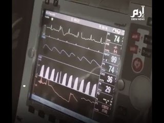 تعرف على أسوأ عام في التاريخ #إرم_نيوز