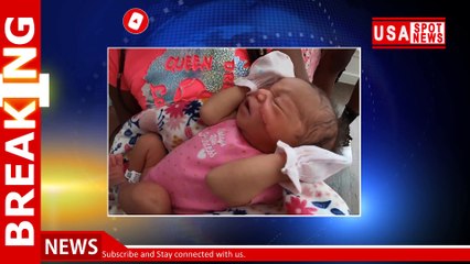 Newborn's face sliced open during emergency C-section