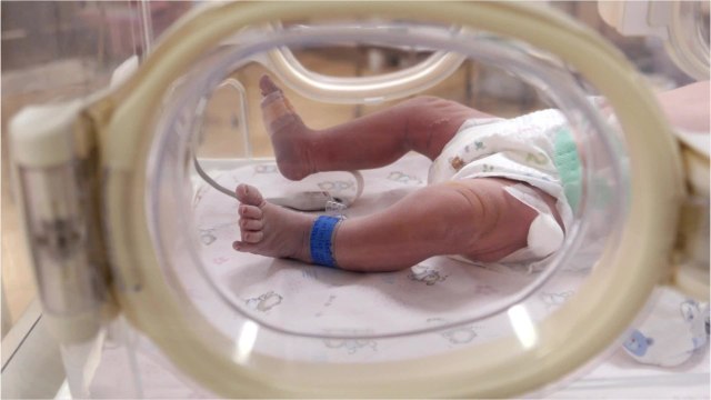 World's Most Premature Baby Celebrates First Birthday