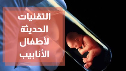 التقنيات الحديثة في أطفال الأنابيب