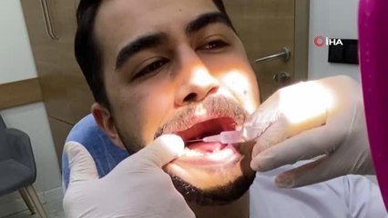Diş hekimi ağrıyan 20'lik dişini kendi çekti