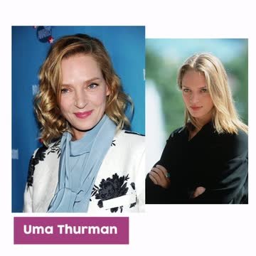 Antes y después famosas cirugía