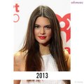 La transformación facial de Kendall Jenner