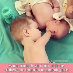Un niño sin brazos le pone el chupete a su hermanito