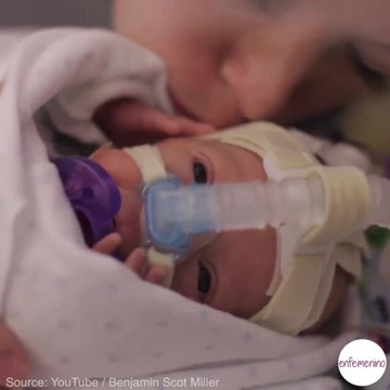 La aventura de un bebé prematuro