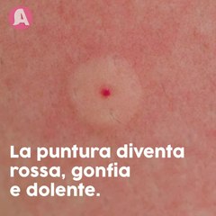 Punture d'insetto: come riconoscere le 5 più comuni