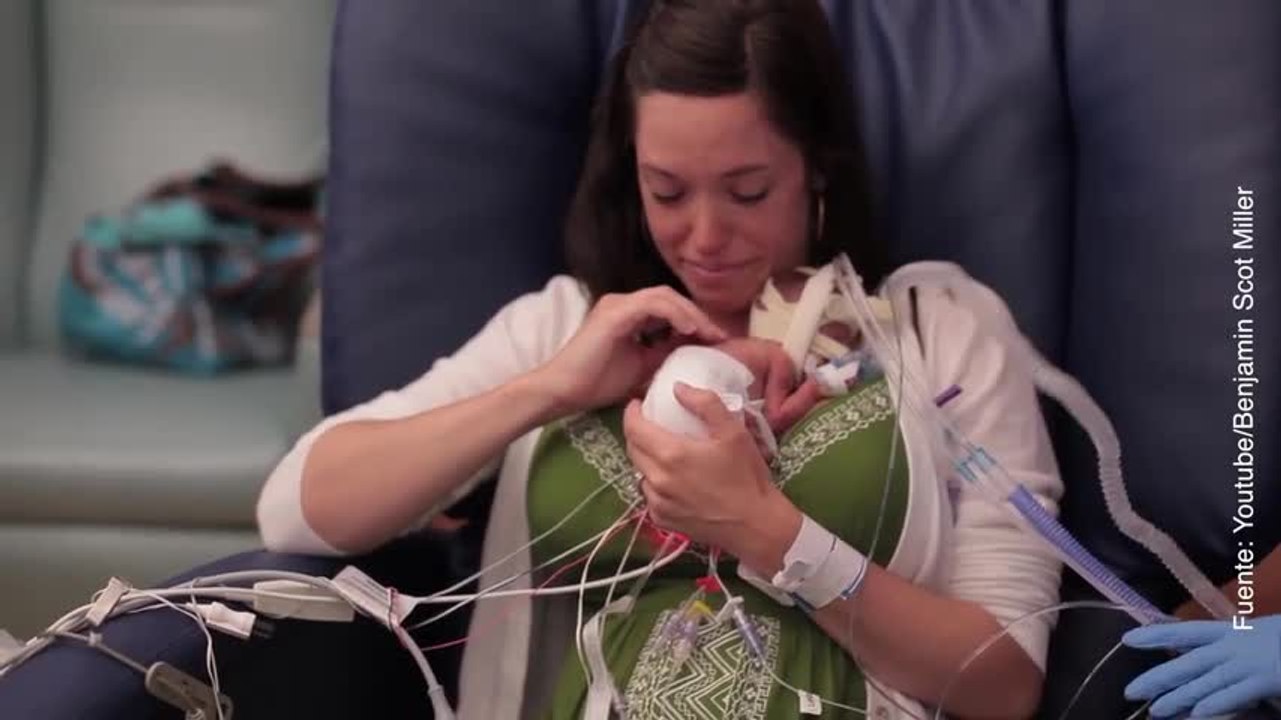 El bebé prematuro que empezó a vivir 3 meses y medio antes de tiempo