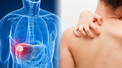 Liver की बीमारी के संकेत,Skin पर दिखने लगते है ये बदलाव, भूलकर भी न करें नजरअंदाज । Boldsky