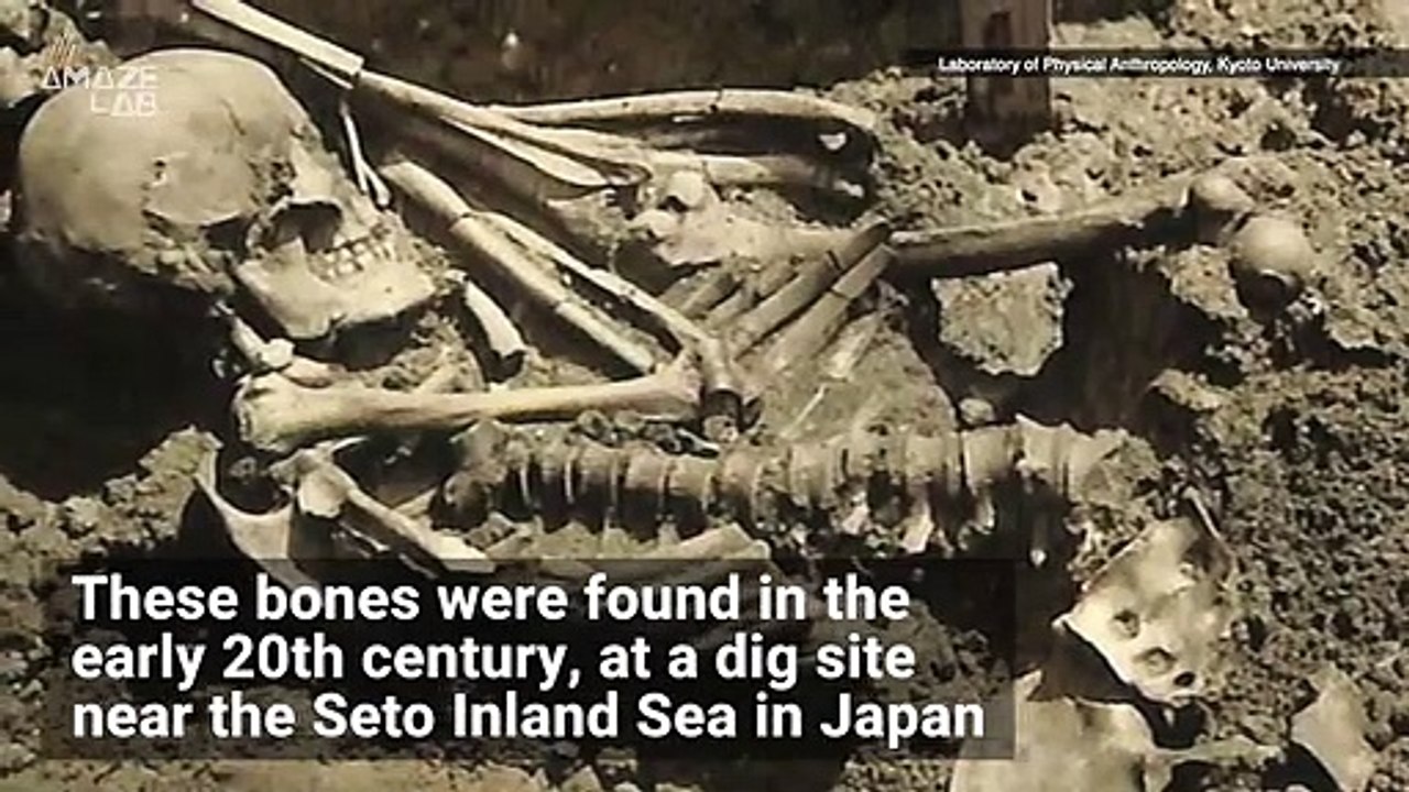 These 3,000-Year-Old Human Remains Show Injuries of the Earliest Known Shark Attack