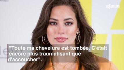 Ashley Graham se confie sur sa perte de cheveux