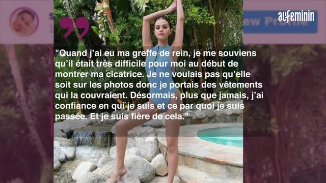 Selena Gomez affiche fièrement ses cicatrices