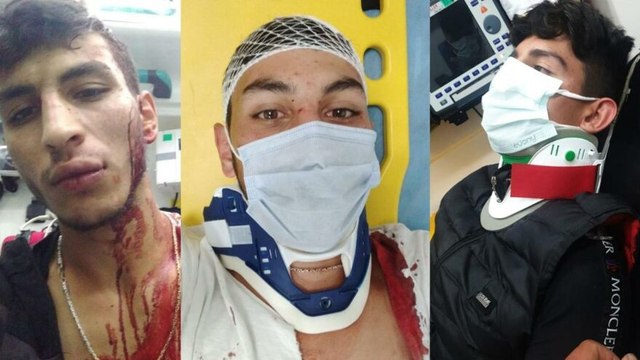 Düğün konvoyunun önünü kesince hastanelik oldular