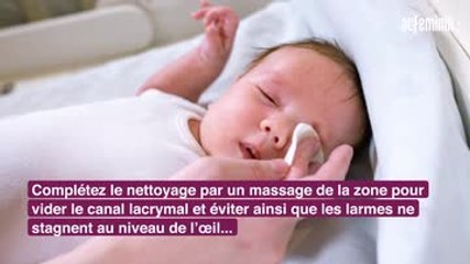 Bébé a une conjonctivite, comment le soulager