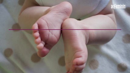 Test de Guthrie : à quoi sert ce dépistage